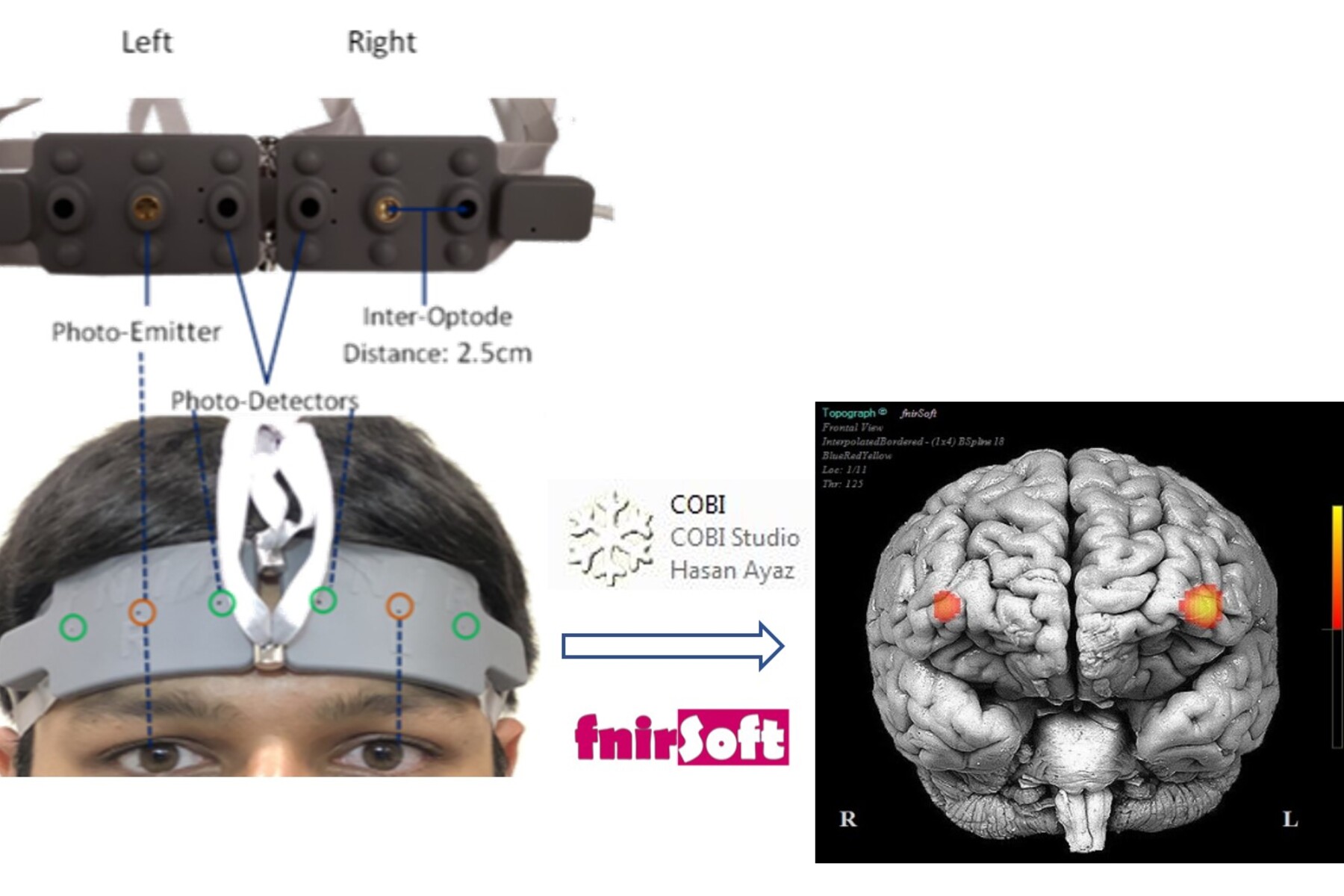 An example of a fNIRS scan