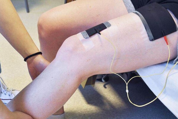 Photo of NMES to the lower limb